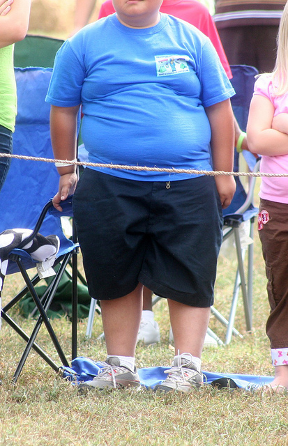 morbidly obese child