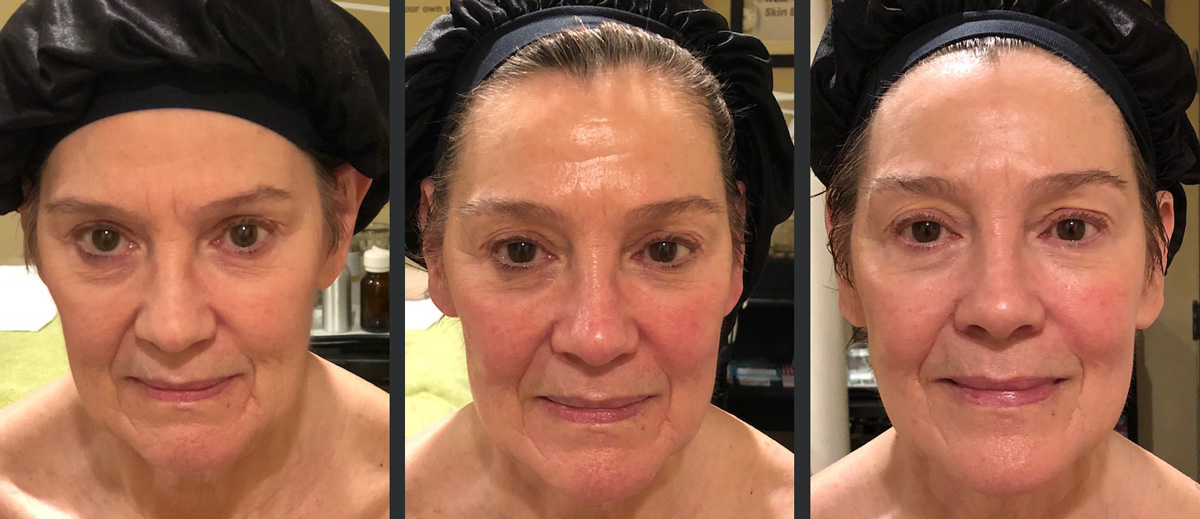 Test Drive Will A Gua Sha Facial Actually Make You Look Younger Atlanta Magazine